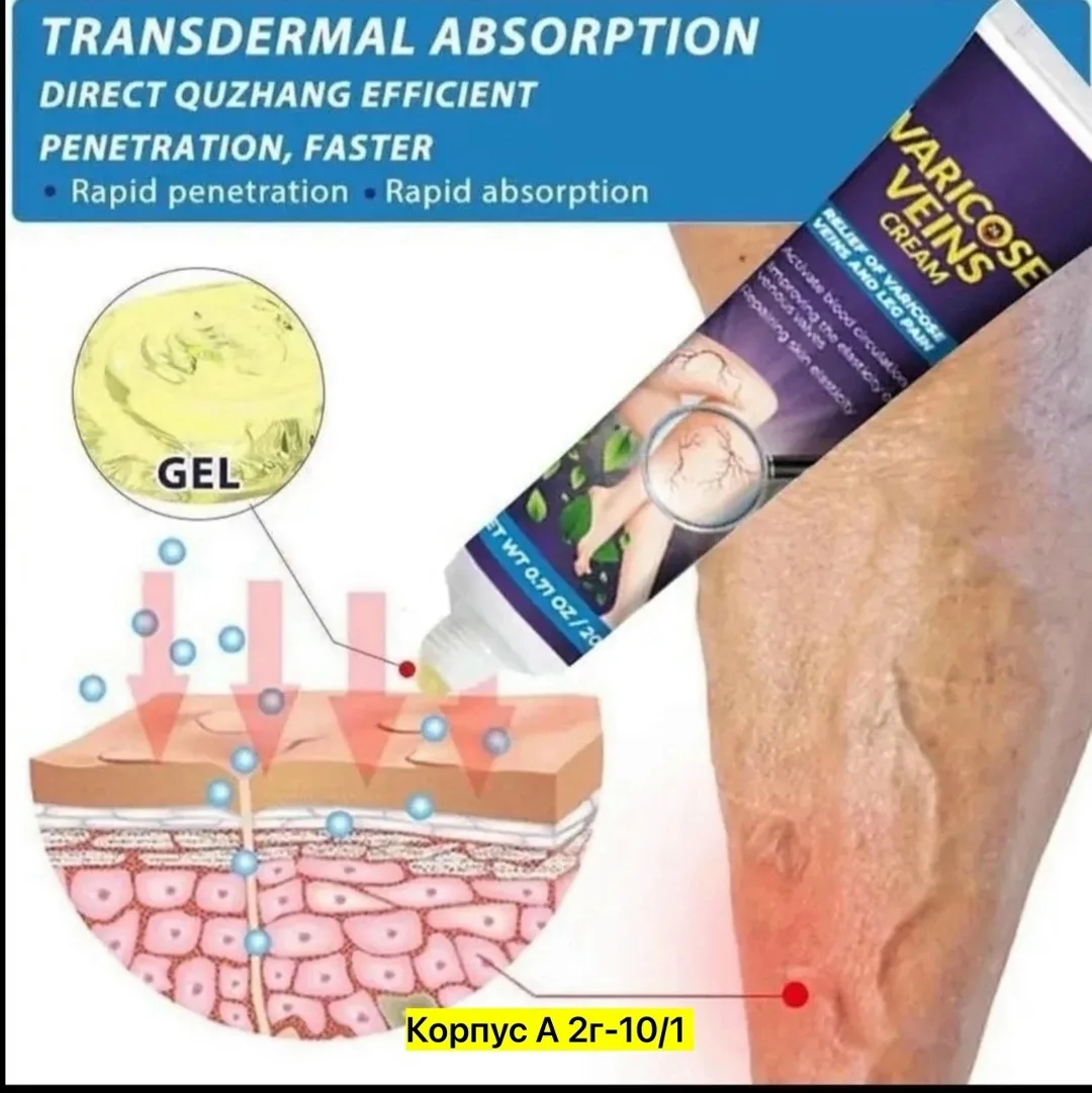 Крем для лечения варикозного расширения вен KanyeHB Varicose Veins Ointment 20g — фото 1