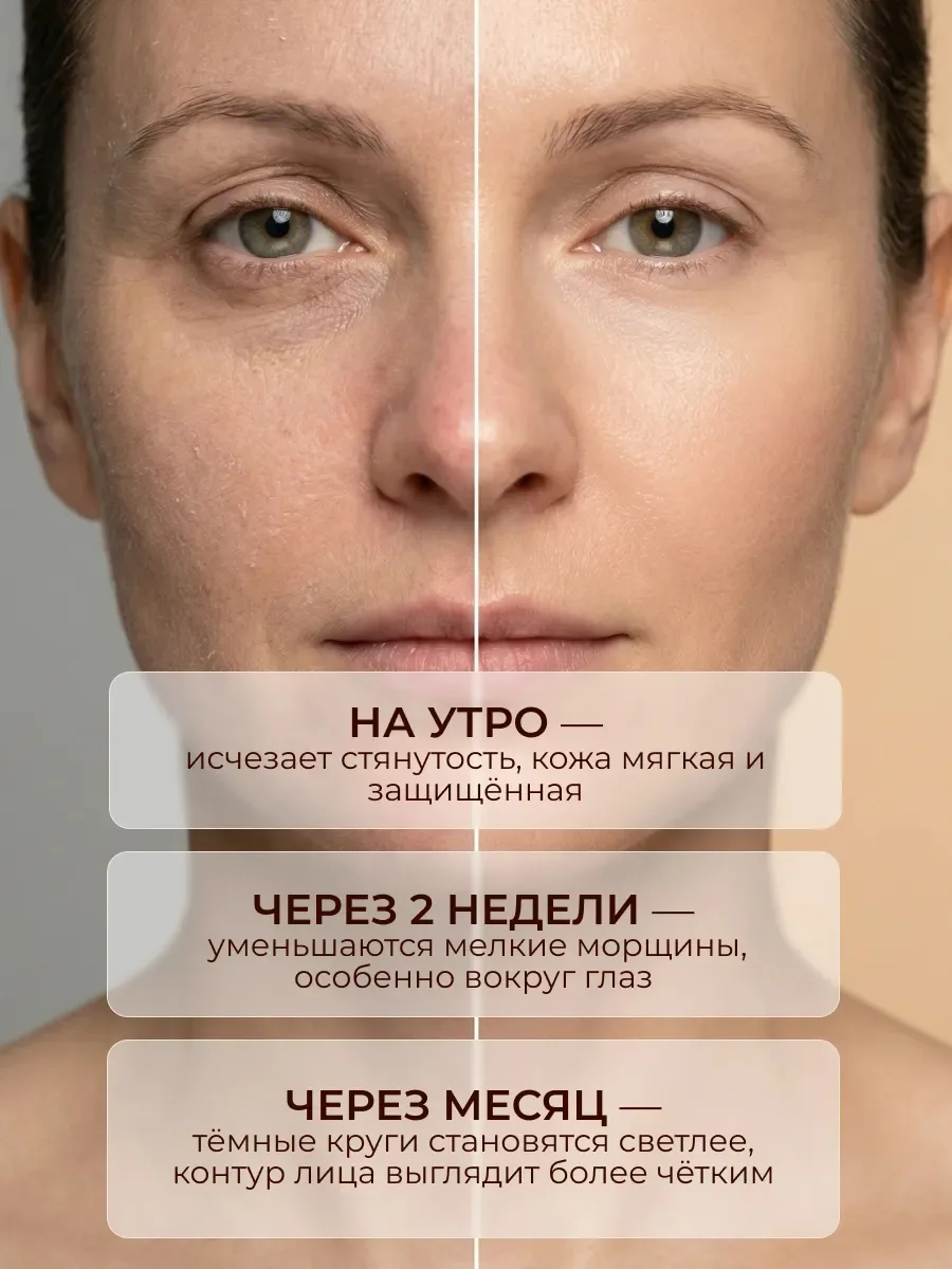 Крем эффективно устраняет темные круги под глазами, активизируя обменные процессы в клетках, что делает взгляд более отд — фото 3