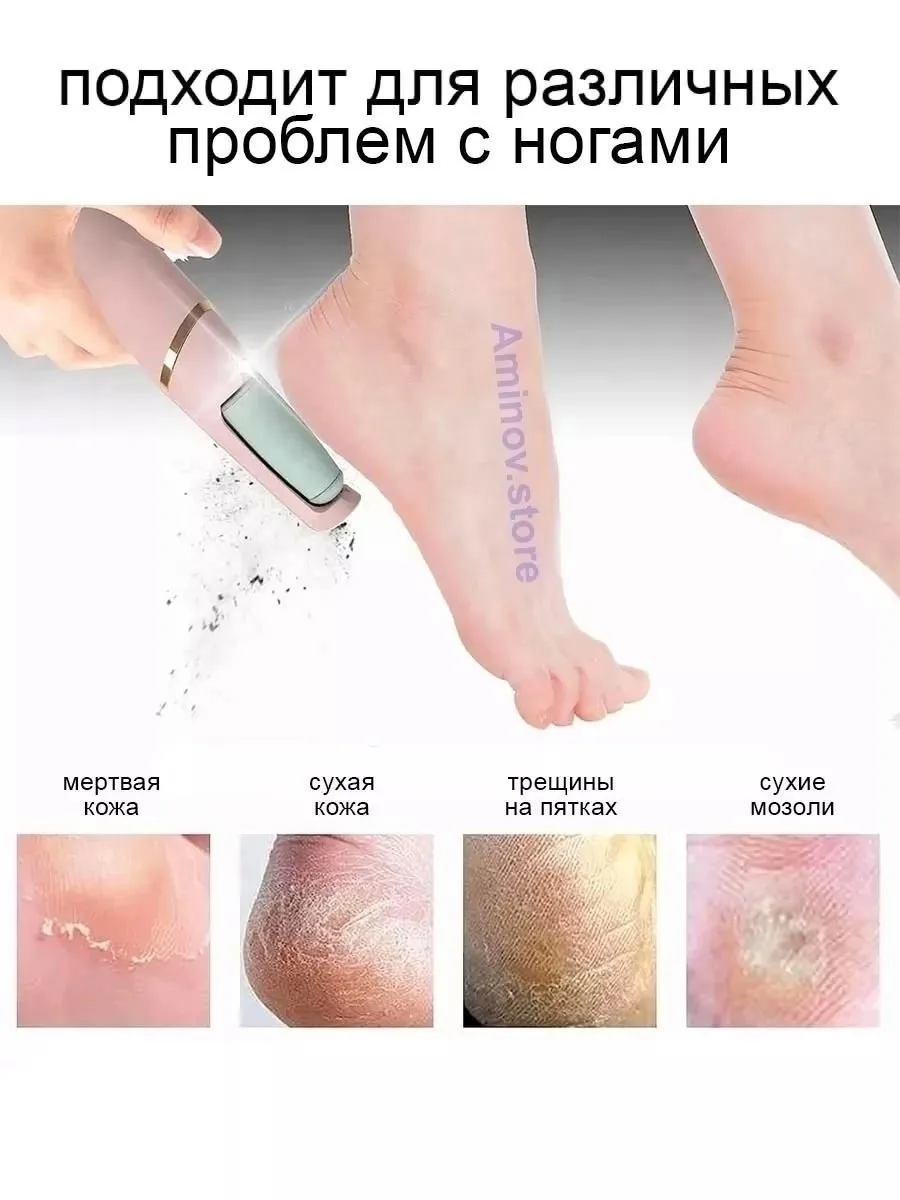 Уход за ногами — фото 3