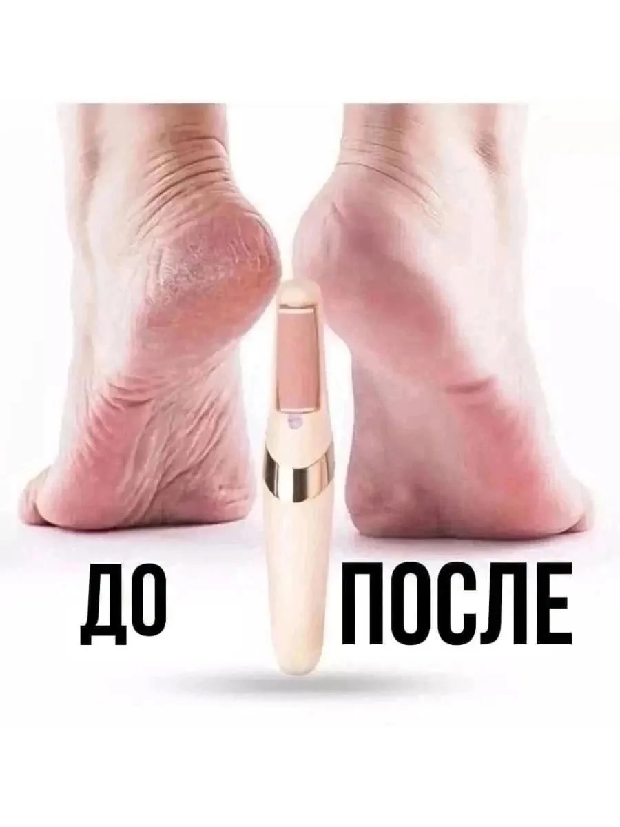 Уход за ногами — фото 8