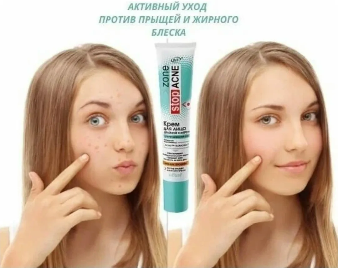 Перчатки Zone Stop Acne Вся продукция оригинальная, имеются сертификаты — фото 3