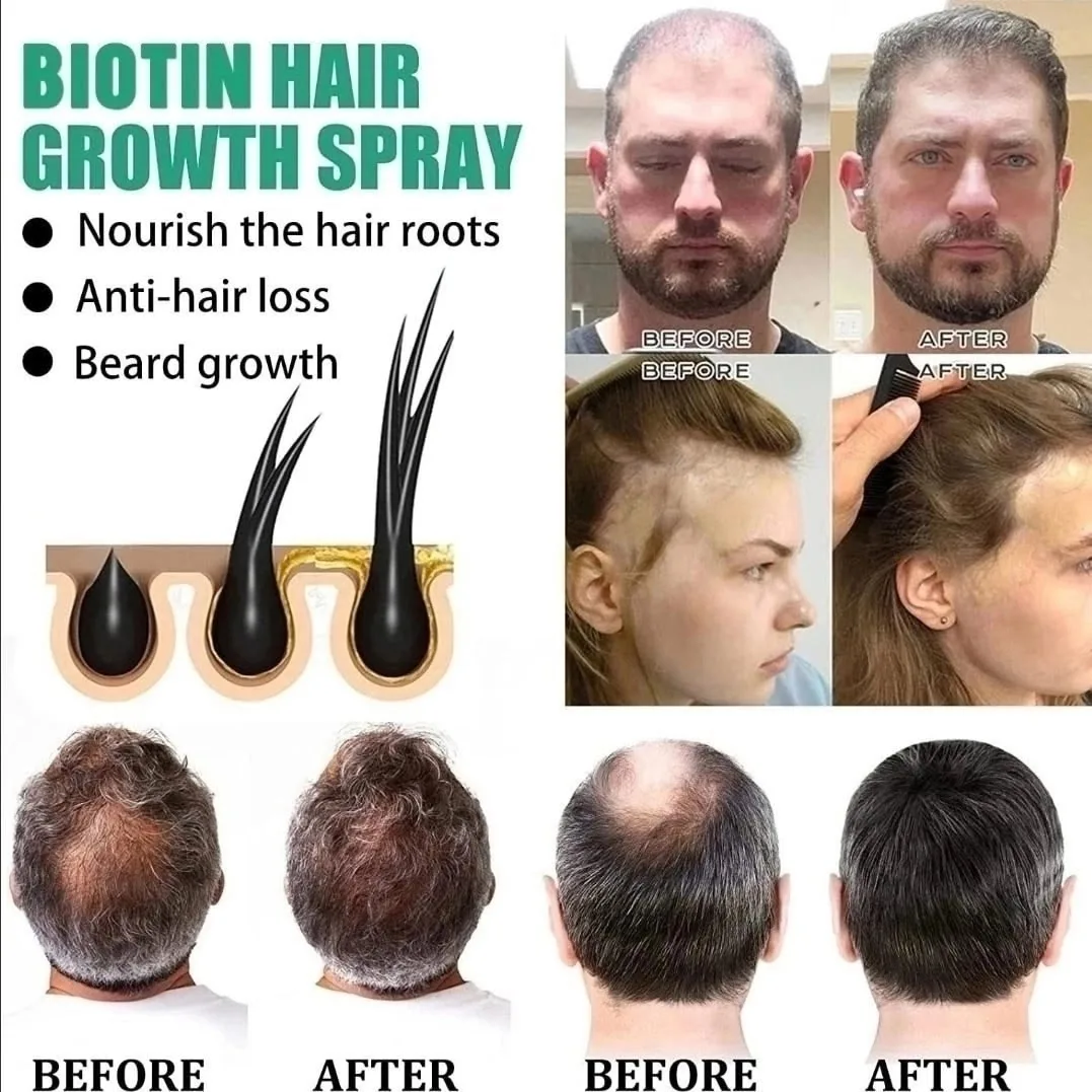 Ibealee Biotin Hair Growth 𝐍𝐞𝐰 — фото 2