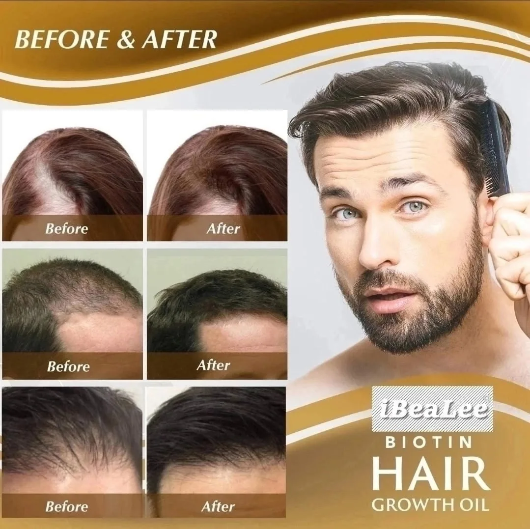 Ibealee Biotin Hair Growth 𝐍𝐞𝐰 — фото 4