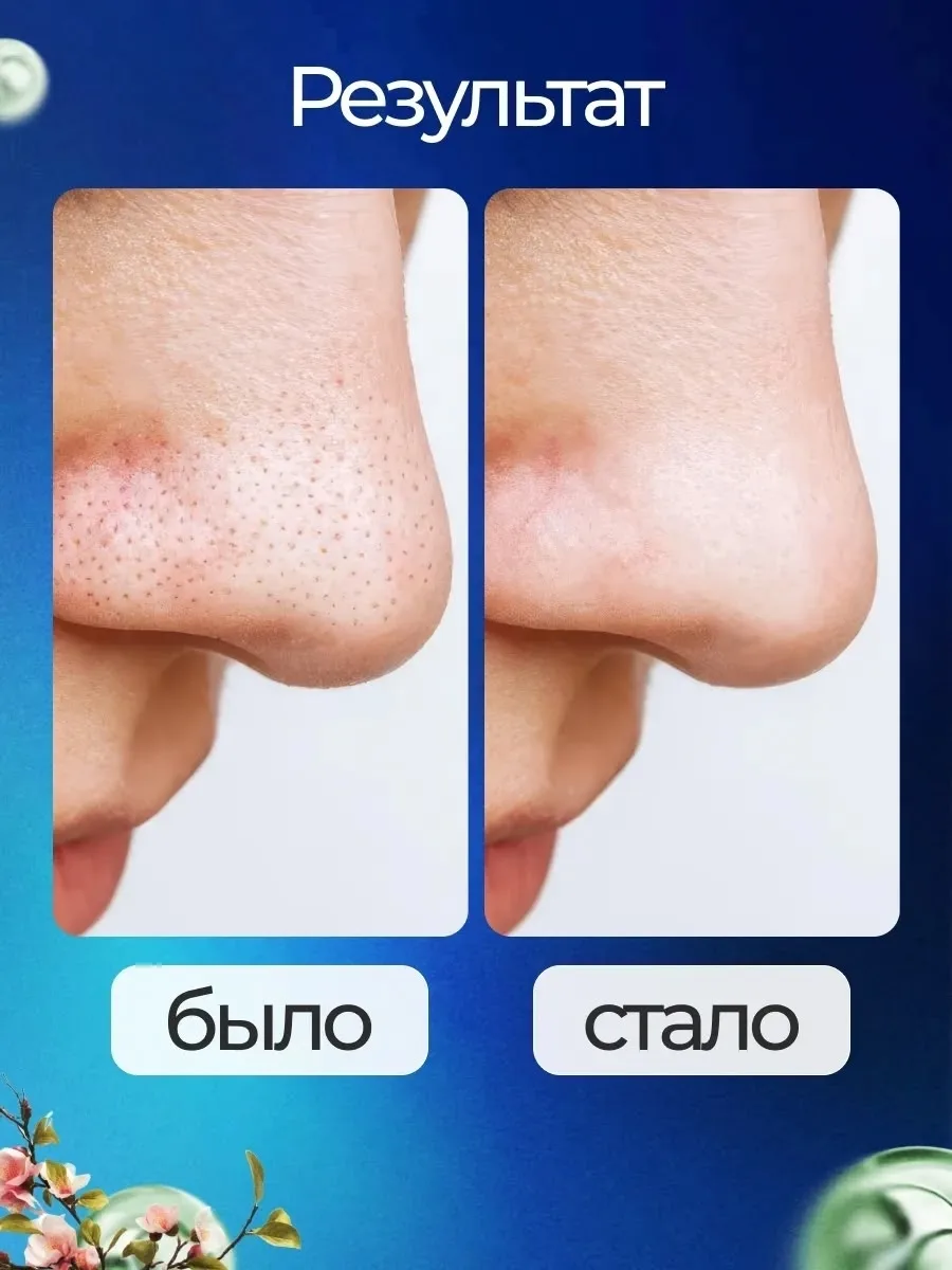 Пузырьковая маска для лица с азелаиновой кислотой SADOER — фото 4