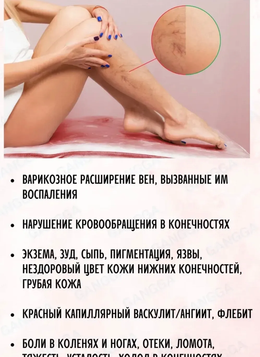 Мазь от варикоза, от растяжек, от боли в ногах — фото 1