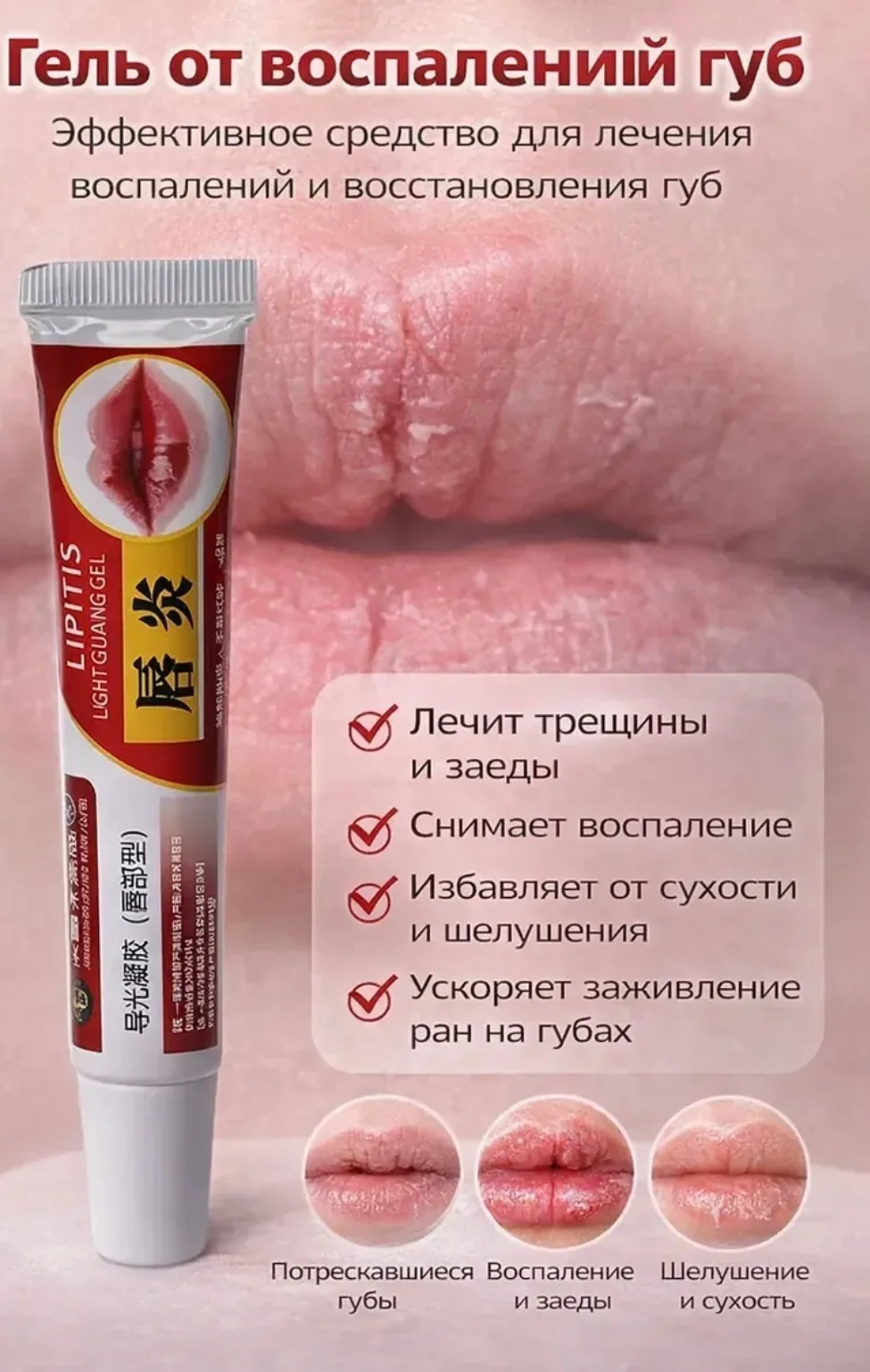 Ключевые запросы гель для губ, увлажнение губ, средство от сухости губ, от трещин губ, заживляющий бальзам, уход за губа — фото 2