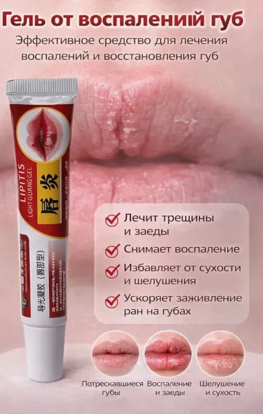 Ключевые запросы гель для губ, увлажнение губ, средство от сухости губ, от трещин губ, заживляющий бальзам, уход за губа — фото 2
