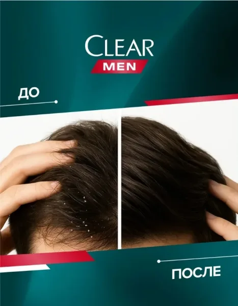 Новая формула глубоко очищающего шампуня-пилинга Clear Derma Expert разработана с учетом особенностей мужской кожи голов — фото 6
