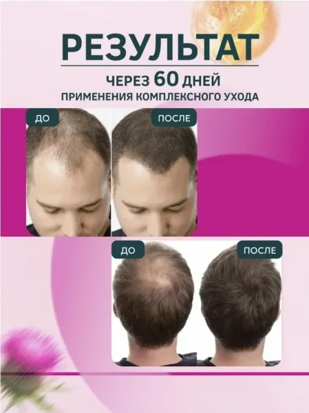 Шампунь Витэкс Репейник для роста волос, белорусская косметика — фото 2