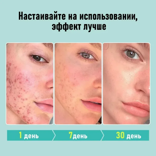 Крем для лица с салициловой кислотой и ниацинамидом разработан для ухода за комбинированной, жирной, проблемной и склонн — фото 6