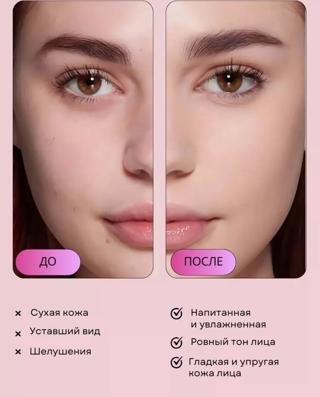 Антивозрастной увлажняющий крем для лица — фото 13