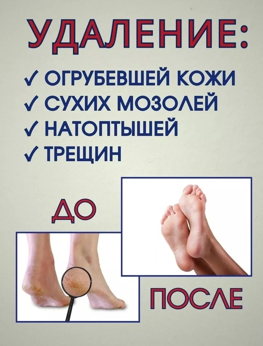 Тапки Bio Gel К. Б — фото 2