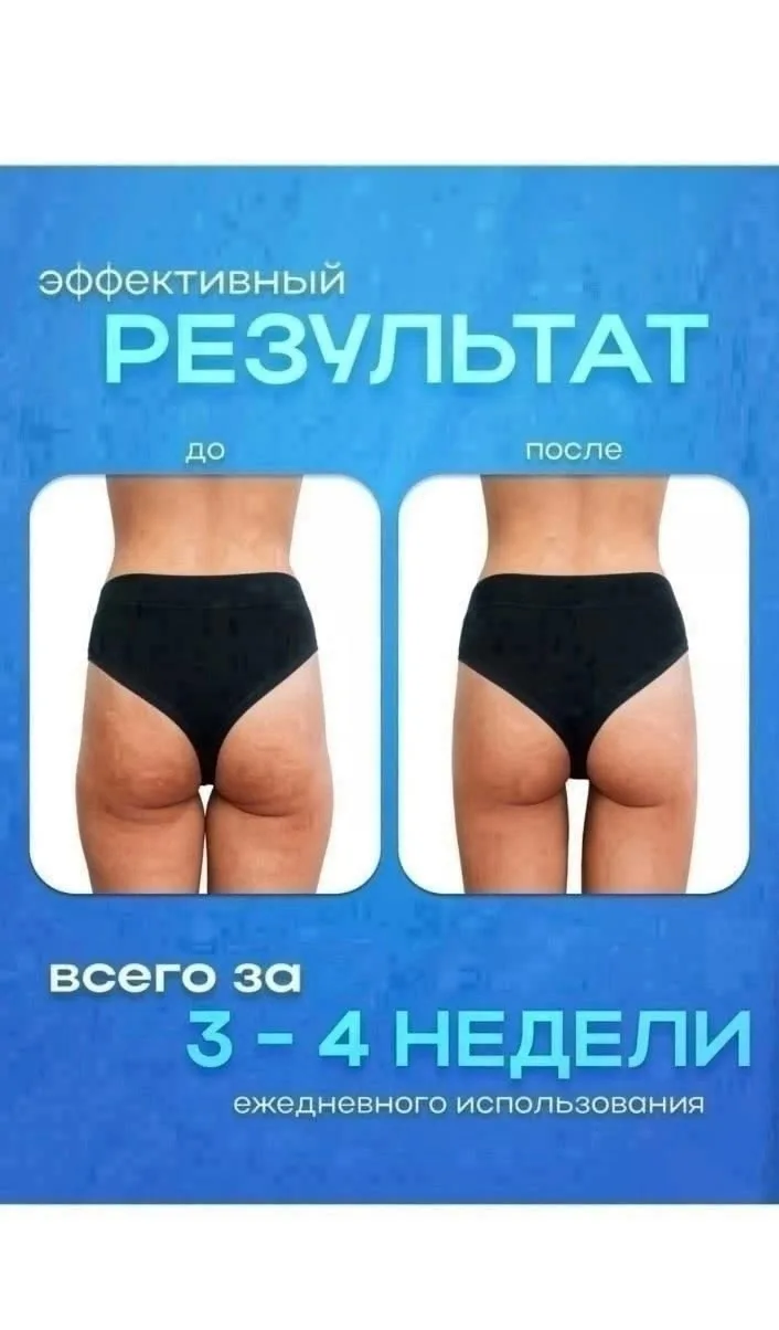 Вакуумный антицеллюлитный электрический, кожа — фото 3