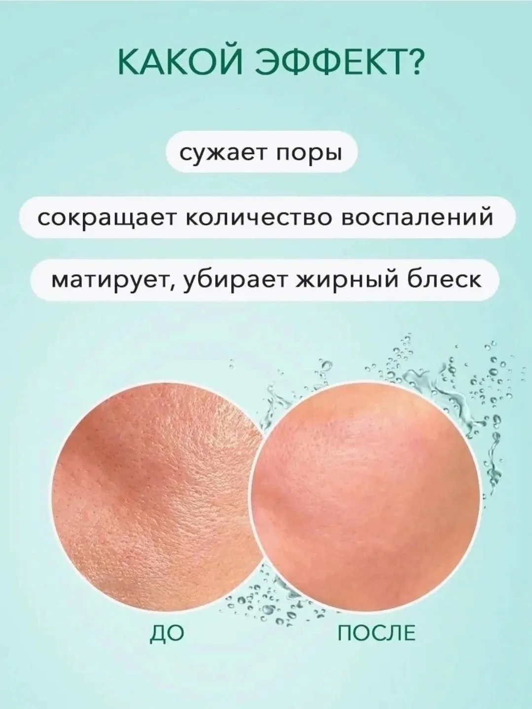 Ночная маска для лица очищающая питательная от прыщей Чёрный — фото 2