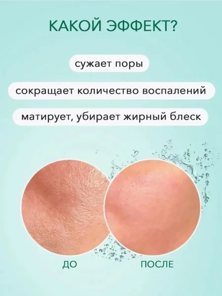 Ночная маска для лица очищающая питательная от прыщей Чёрный — фото 2