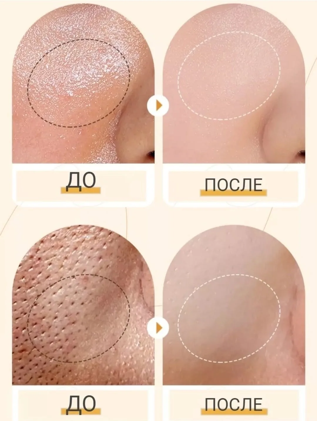 Универсальная пенка для умывания с мягкой массажной щеточкой — фото 9