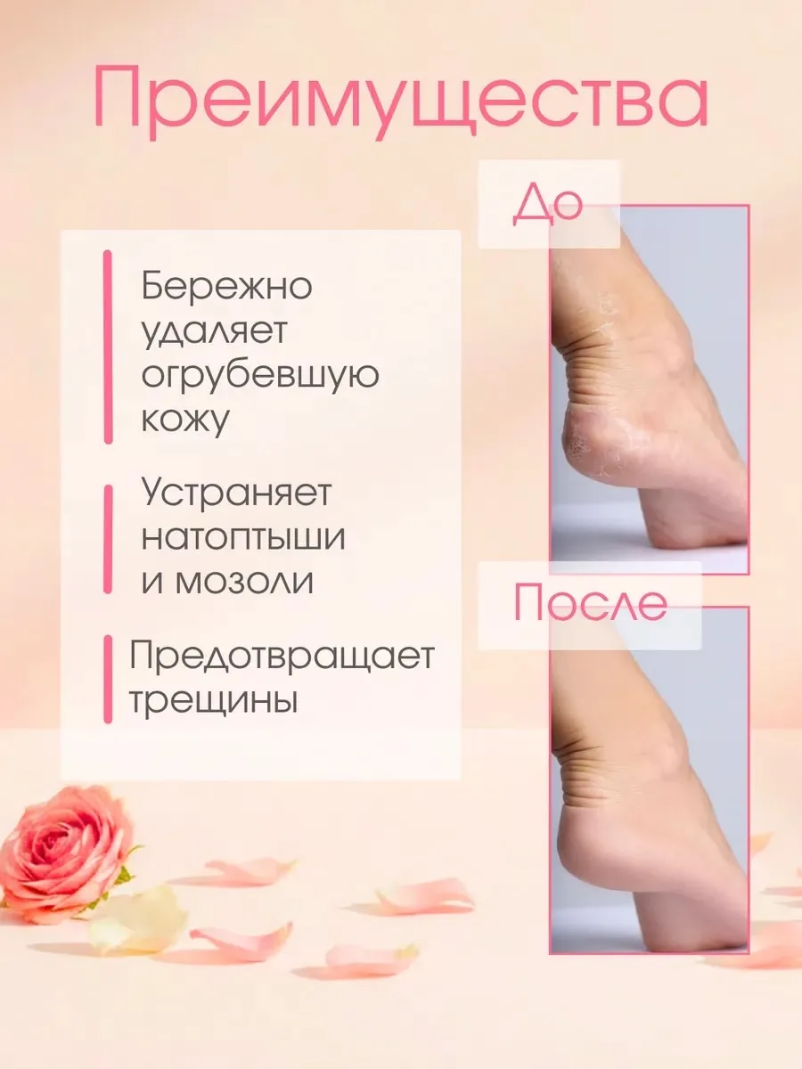 Тапки ДЛЯ УХОДА ЗА СОБОЙ — фото 2