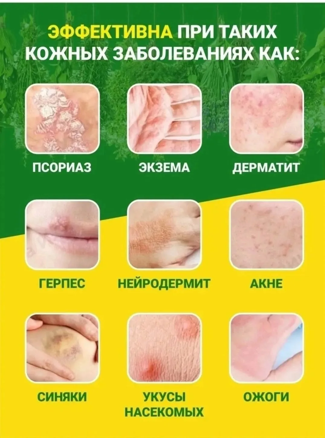 Тапки, кожа — фото 2
